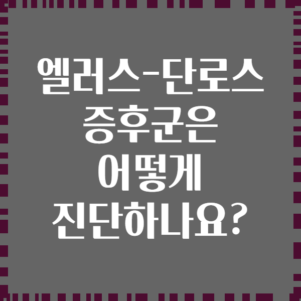 엘러스-단로스 증후군은 어떻게 진단하나요?